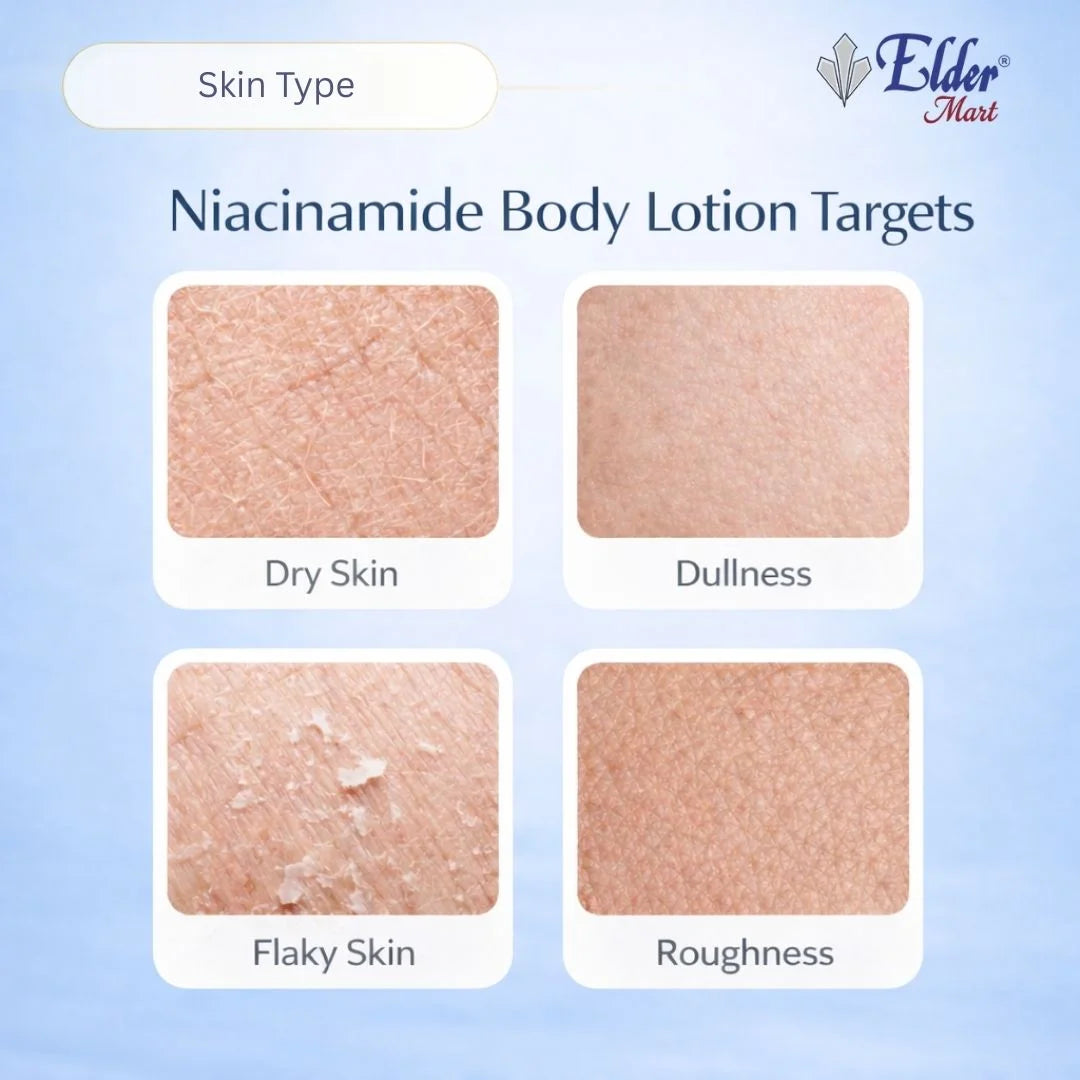 Elder Mart niacinamide body lotion targets for different skin types on a light blue background.